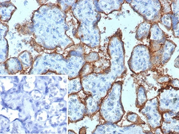 CD168 Antibody / HMMR