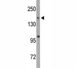 Western blot analysis of Dnmt1 antibody and MDA-MB435 lysate. Predicted molecular weight: 180-200 kD