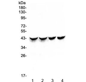 Western blot testing of multiple lots of rat heart lysate (1 & 2) and mouse heart lysate (3 & 4) wit