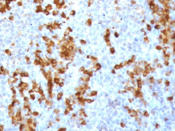 IHC staining of FFPE human tonsil tissue with recombinant Kappa light chain antibody (clone KC3L-3R)