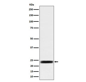 Western blot testing of human HEK293 cell lysate with ARFRP1 antibody. Predicted molecular weight ~2