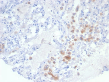 IHC staining of FFPE human lung tissue with IRS1 antibody (clone IRS1/7571). HIER: boil tissue secti
