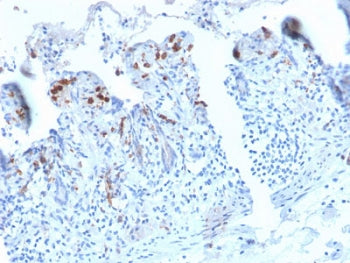 IHC staining of FFPE human small intestine with recombinant DC-SIGN antibody (clone C209/2749R). HIE