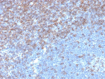 IHC staining of FFPE human tonsil tissue with CD5 antibody (clone rC5/6976). HIER: boil tissue secti