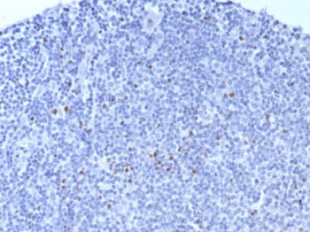 IHC staining of FFPE human tonsil tissue with Forkhead box protein P3 antibody (clone FOXP3/8015R). 