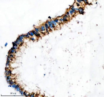 Immunohistochemical staining of IFT20 using anti-IFT20 antibody. IFT20 was detected in a paraffin-em