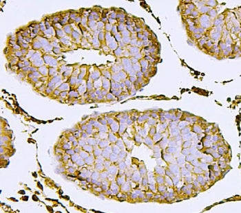 IHC staining of FFPE rat testis with Nectin 2 antibody. HIER: boil tissue sections in pH8 EDTA for 2
