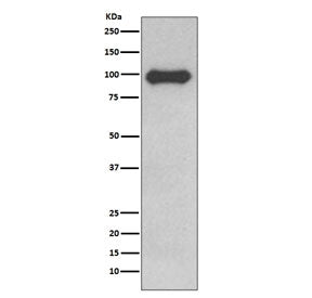 Western blot testing of human Ramos cell lysate with CD19 antibody. Expected molecular weight: 60-10