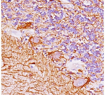Neurofilament Antibody (-Heavy) / NF-H / NEFH