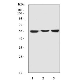 Western blot testing of 1) human HCCP, 2) rat liver and 3) mouse liver lysate with Cytochrome P450 2