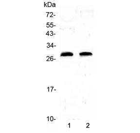 Western blot testing of 1) rat heart and 2) rat lung lysate with C-Reactive Protein antibody at 0.5u