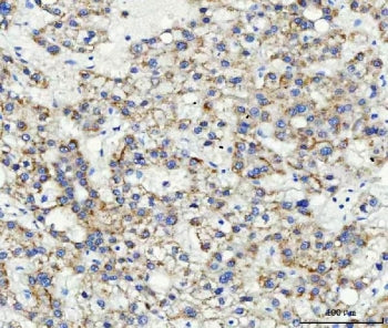 ABCB4 Antibody