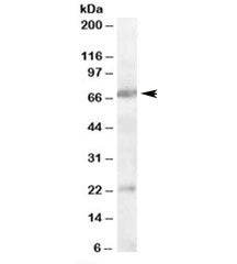 Western blot testing of rat brain lysate with CHRNA4 antibody at 0.3ug/ml. Predicted/observed molecu