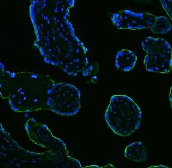 Placental Alkaline Phosphatase Antibody / ALPP