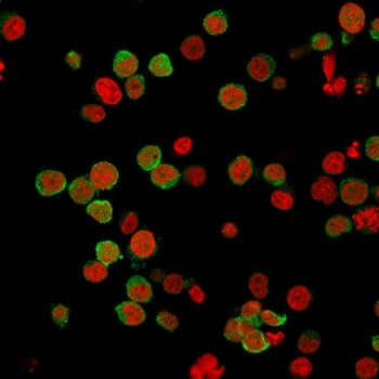 Immunofluorescent staining of PFA-fixed human Jurkat cells with ZAP-70 antibody (green, clone 2F3.2)