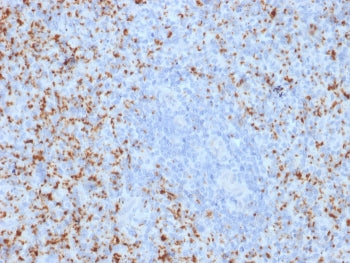 IHC testing of FFPE human spleen with ITGB3 antibody. Required HIER: boil tissue sections in 10mM Tr