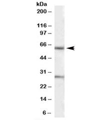 Western blot testing of human heart lysate with KCNQ1 antibody at 1ug/ml. Predicted molecular weight