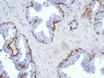 Cytokeratin 5 Antibody / KRT5