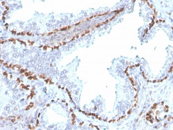 IHC staining of FFPE human kidney with recombinant p40 antibody (clone rTP40/3690). HIER: boil tissu