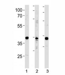 NeuroD1 antibody western blot analysis in 1) Y79 cell line, 2) mouse cerebellum and 3) rat brain tis
