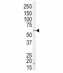 Western blot analysis of NRG1 antibody and SK-BR-3 lysate. Predicted molecular weight of multiple is