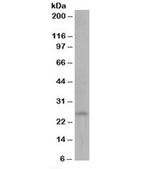 Western blot testing of human kidney lysate with DCXR antibody at 0.1ug/ml. Predicted molecular weig