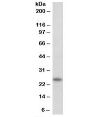 Western blot testing of human skeletal muscle lysate with TNNI1 antibody at 0.03ug/ml. Predicted mol