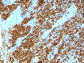 CD45RA Antibody (Leukocyte marker)