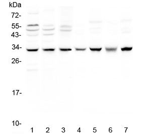 Western blot testing of 1) human MCF7, 2) A549, 3) SGC-7901, 4) rat brain, 5) rat heart, 6) mouse br
