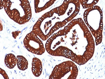 KRT19 Antibody / Cytokeratin 19