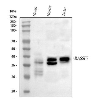 Western blot analysis of RASSF7 using anti-RASSF7 antibody. Lane 1: human HL-60 whole cell lysates, 
