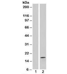 Western blot testing of HEK293 lysate overexpressing FABP2 with FABP2 antibody [mock transfection in