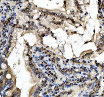 IHC staining of FFPE rat colon tissue with SLUG antibody. HIER: boil tissue sections in pH8 EDTA for