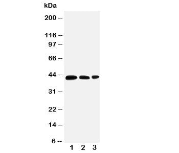 Western blot testing of AQP2 antibody and Lane 1: MCF-7; 2: SW620; 3: HT1080 cell lysate. The protei