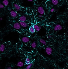 Immunofluorescent staining of frozen human cerebral cortex tissue with recombinant GFAP antibody (bl