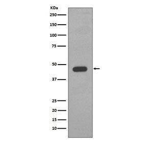 Western blot testing of human A431 cell lysate with Cytokeratin 14 antibody. Predicted molecular wei