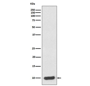 Western blot testing of human HeLa cell lysate with S100A6 antibody. Predicted molecular weight ~10 