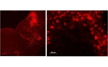IHC testing of FFPE mouse brain stem in sagittal (left) and coronal (right) sections of Raphe nuclei