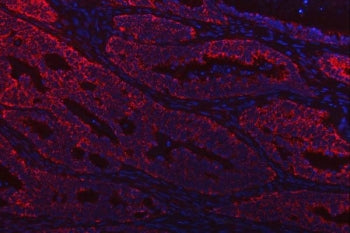 Thiosulfate sulfurtransferase Antibody / TST