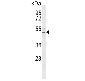 Western blot testing of human NCI-H292 cell lysate with S1PR4 antibody. Predicted molecular weight ~