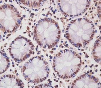 IHC testing of FFPE human colon tissue with SMAD1 antibody. HIER: steam section in pH6 citrate buffe