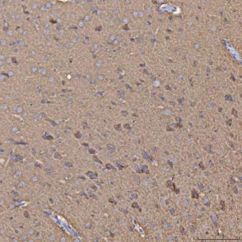 SEPHS1 Antibody / Selenophosphate synthetase 1