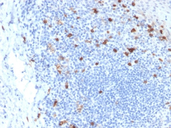 IHC testing of FFPE human tonsil with CD103 antibody (clone ITGAE/2063). HIER: boil tissue sections 