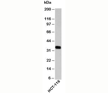 Western blot testing of human samples with EpCAM antibody at 2ug/ml. Expected molecular weight: ~35 