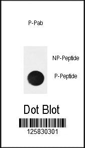 Dot blot analysis of phospho-IkBa antibody. 50ng of phos-peptide or nonphos-peptide per dot were spo