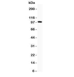 Western blot testing of Prothrombin antbody and rat testis lysate; Predicted molecular weight: 70 kD
