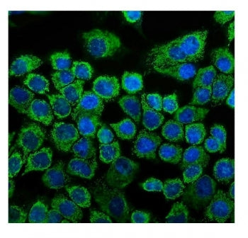 HSP60 Antibody