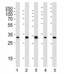 RPS6 Antibody