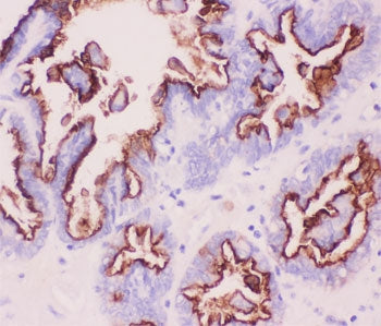 MUC1 Antibody
