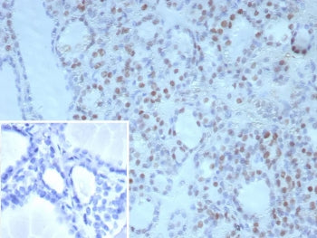 IHC staining of FFPE human thyroid tissue with NKX2.1 antibody (clone NX2.1/9030). Inset: PBS used i